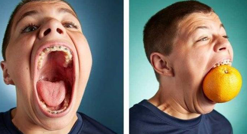 شاب يدخل موسوعة جينيس بسبب فمه الكبير: عرضه 10 سم