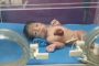 ولادة نادرة لطفل بقلب خارج الجسم.. حالة من كل 5.5 مليون (فيديو)