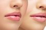 وصفة طبيعية لإزالة السواد حول الفم